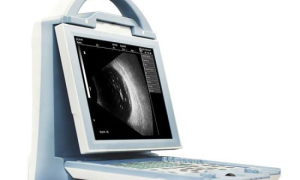 HLHO-300 Full Digital Ophthalmic A/B Ultrasound Scanner